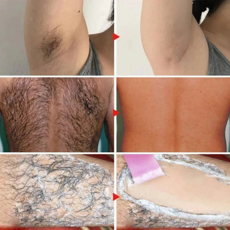 Mycustomary Epilator Cream