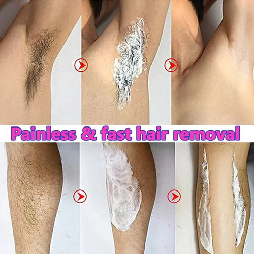 Mycustomary Epilator Cream